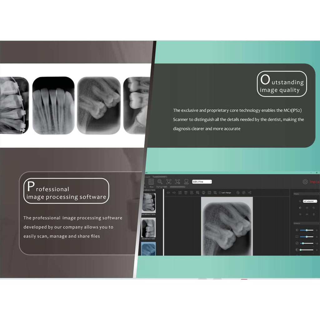 X ray Image Scanner, Dental PSP Scanner Digital Imaging Phosphor Plate Scanner System for Veterinary and Lab